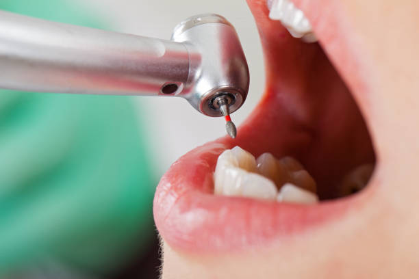 Best Emergency Dental Care for Trauma or Injury in Blue Rapids, KS